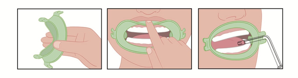 Separador labial Abreboca Optgrade Silicone III Shape x 1 Cotisen