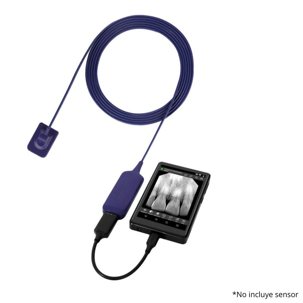 Visualizador de imagenes digital para sensor intraoral Youjoy