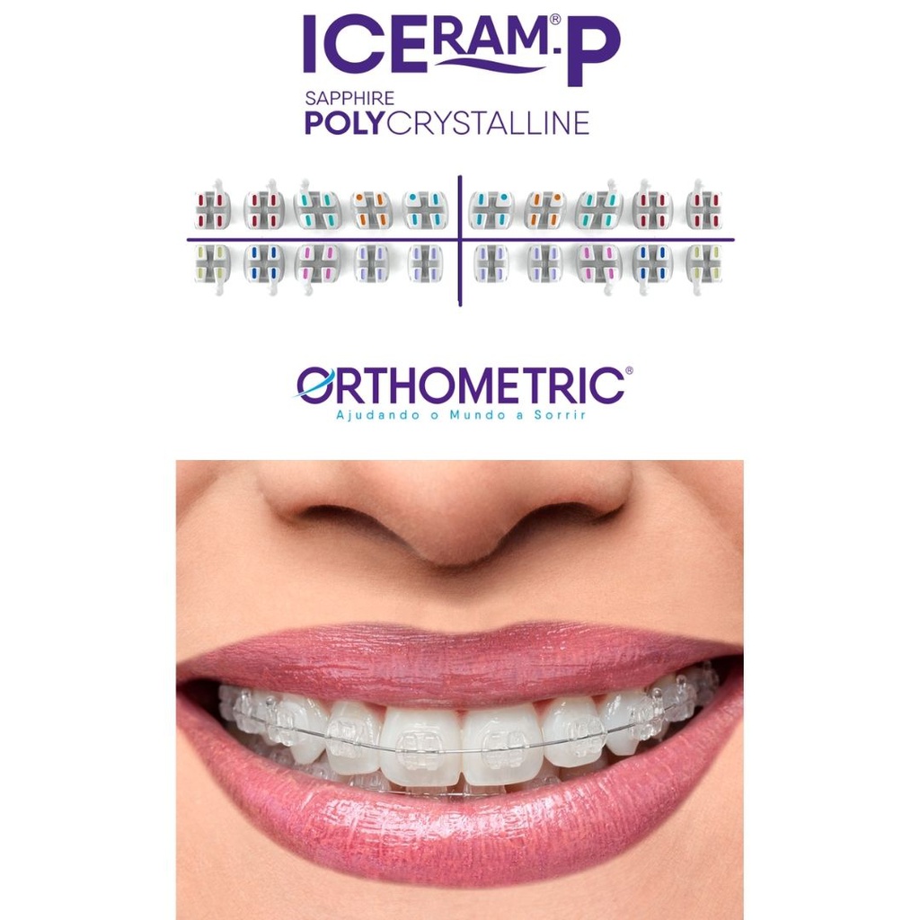 1 Caso Brackets estéticos Poly Zafiro ICeram-P Policristalino Orthometric