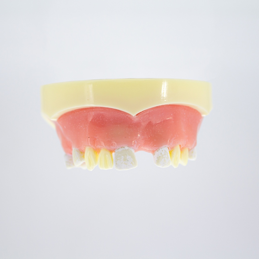 Modelo estudio y práctica Implantología con encía Max. Superior CBCT Machtig