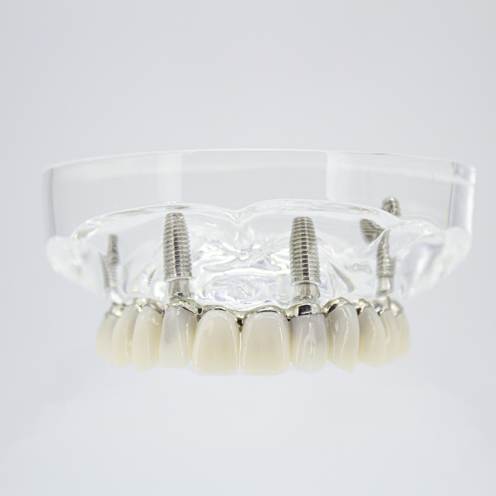 Modelo estudio y práctica Rehabilitación con 4 tornillos Max. Superior M6001-1 Machtig