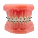 Modelo estudio maxilares Ortodoncia con Bracket autoligado esféricos M7003 Machtig