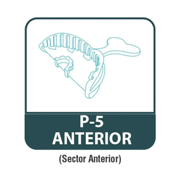 [IMP3175P5] Set de 35 Cubetas para Triple Impresión Anterior Jini Dental
