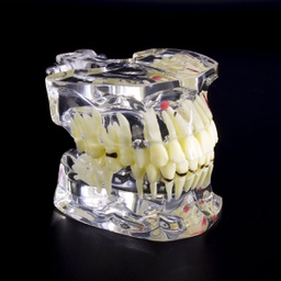 [DIA3816] Modelo estudio Patologías Adulto M4001-2 Machtig