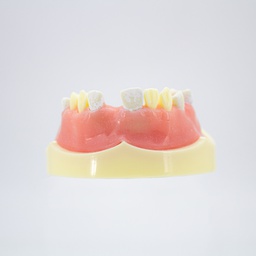 [DIA4199] Modelo estudio y práctica Implantología con encía Max. Superior CBCT Machtig