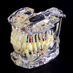 [DIA3006] Modelo estudio Patologías Adulto M4001-1 Machtig