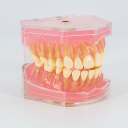 [DIA3007] Modelo estudio maxilares Encía Blanda y Piezas removibles M7008 Machtig