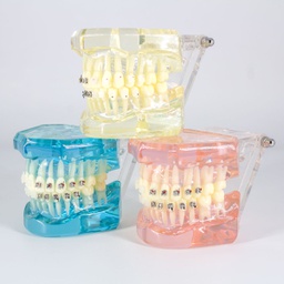 [DIA3008] Modelo estudio maxilares Ortodoncia con Bracket Metal-Cerámica M3003/2 Machtig