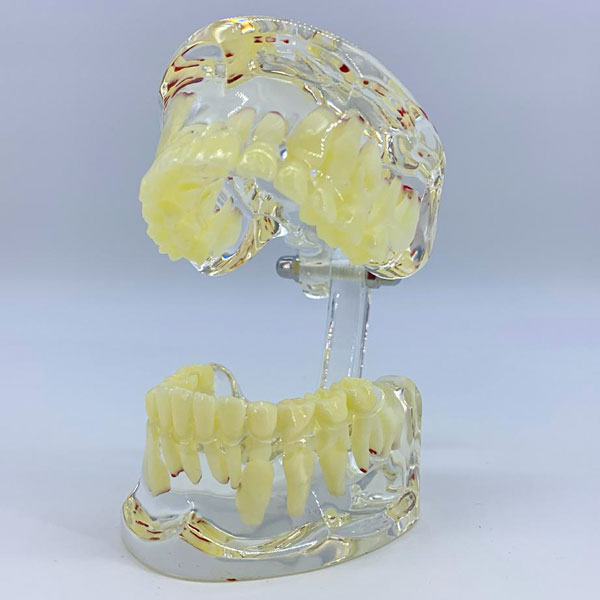 [DIA3647] Modelo estudio Dentición Mixta Niños M7016 Machtig