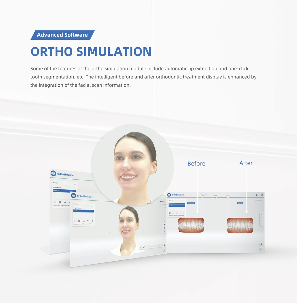 Scanner Facial 3D MetiSmile Shining 3D