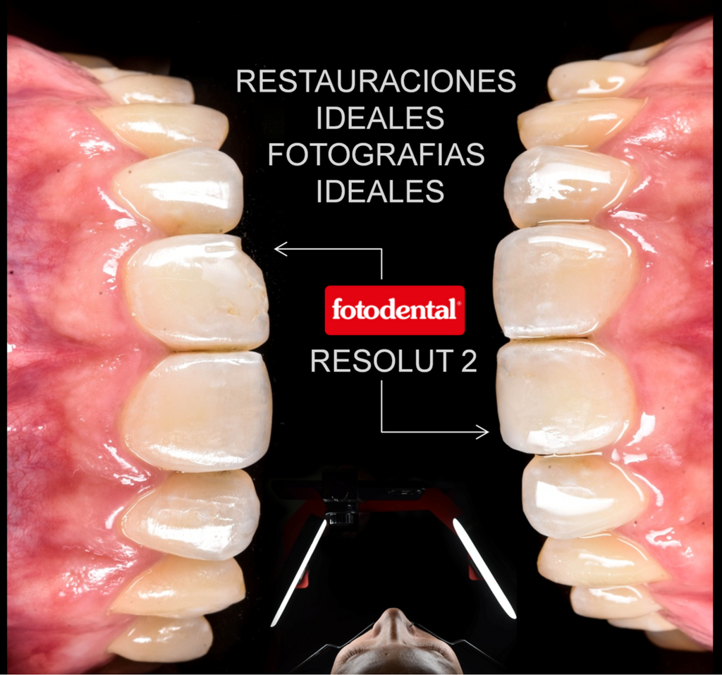 Kit de Iluminación para Fotografía dental Resolut 2-902 Fotodental