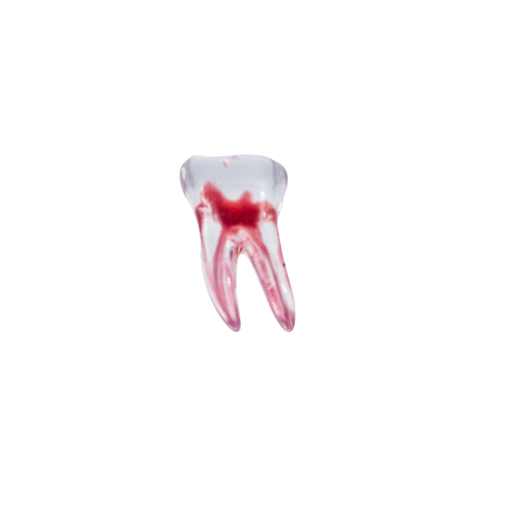 Modelo 3D Molar Superior Machtig