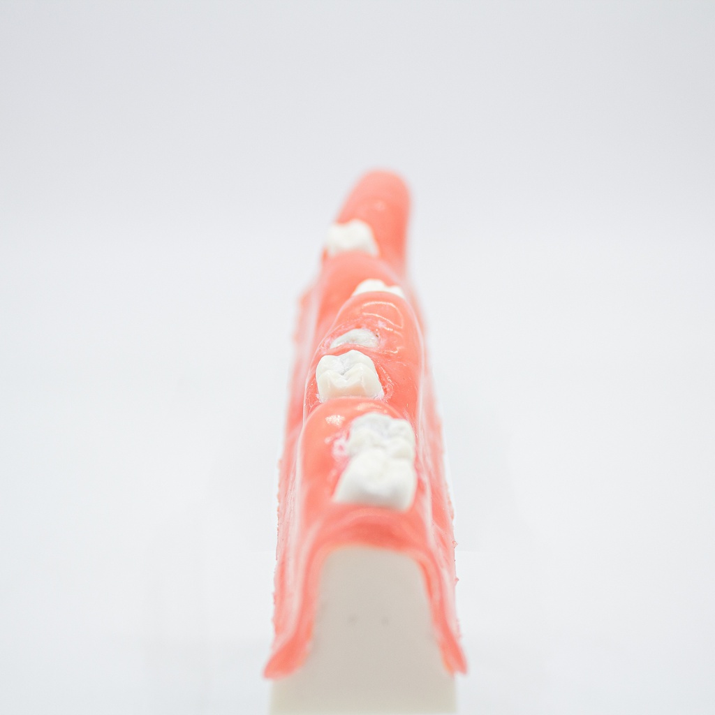 Macromodelo estudio Extracción de dientes impactados CBCT Machtig
