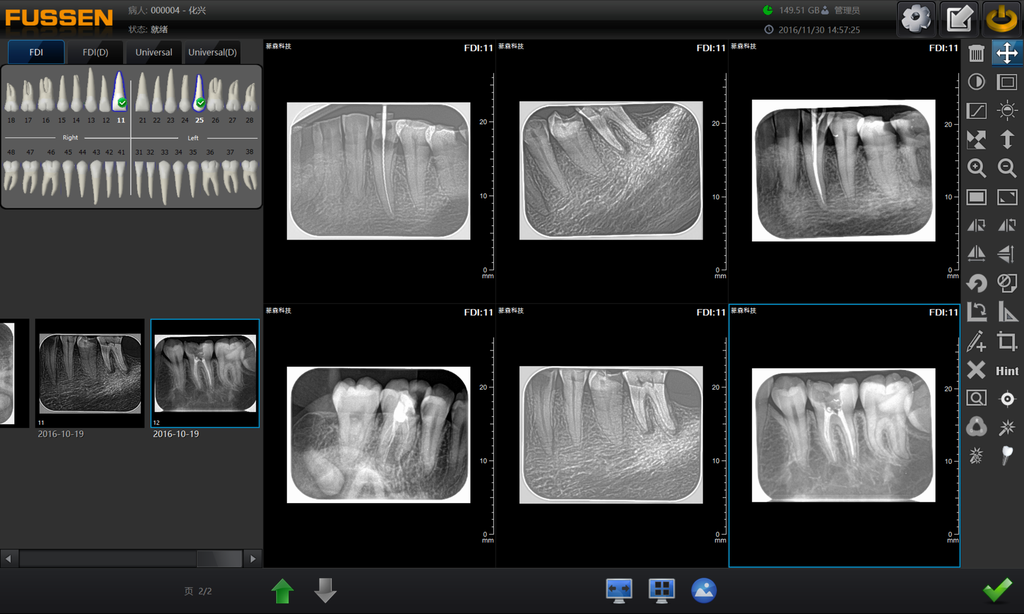 Scanner Digital Placa Fosfato Fussen