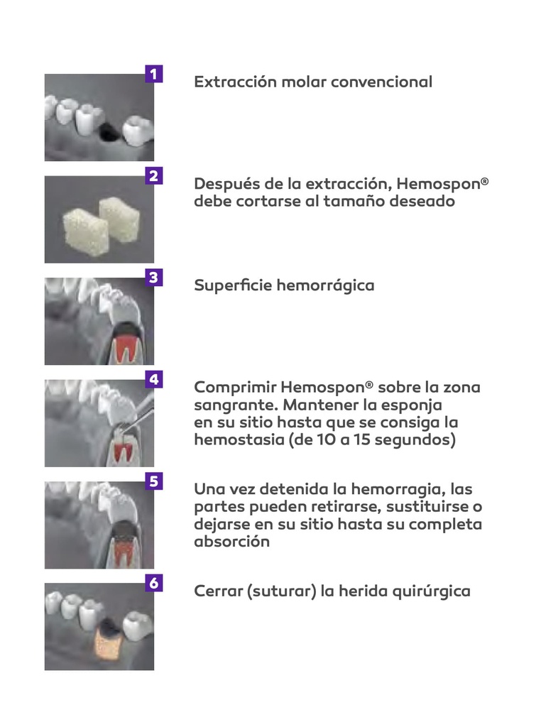 Esponja Hemostática de colágeno Hemospon Cubo x 10 Hemospon