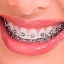 Brackets Autoligado OrthoClip SLB Ultra-P Orthometric