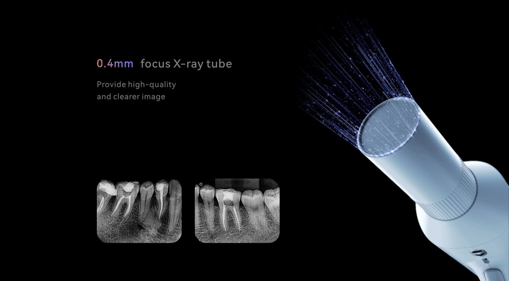 Equipo de Rayos x Portátil Ai-Ray Woodpecker