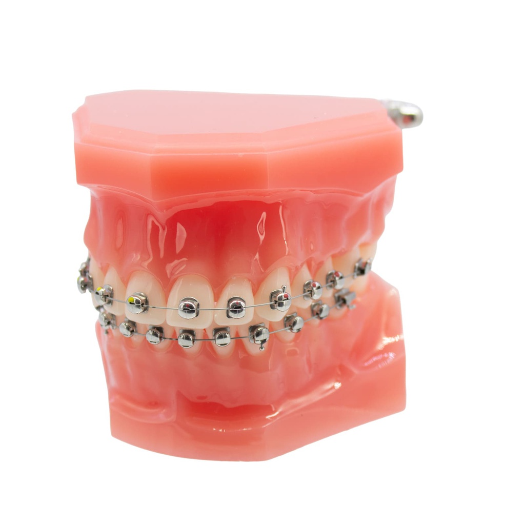 Modelo estudio maxilares Ortodoncia con Bracket autoligado esféricos M7003 Machtig