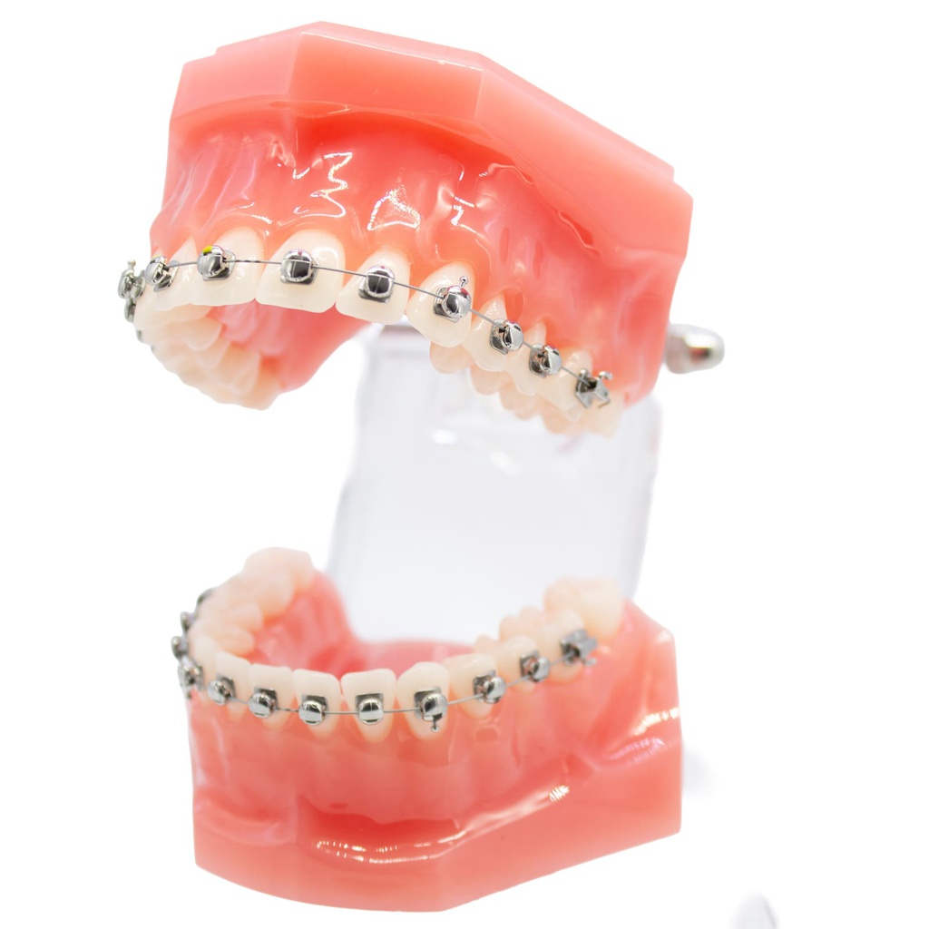 Modelo estudio maxilares Ortodoncia con Bracket autoligado esféricos M7003 Machtig