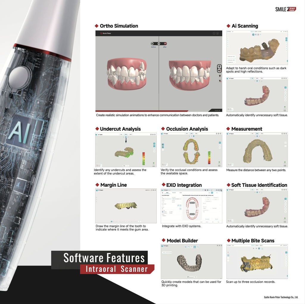 Scanner Intraoral 3D Smile 2 KP Woodpecker