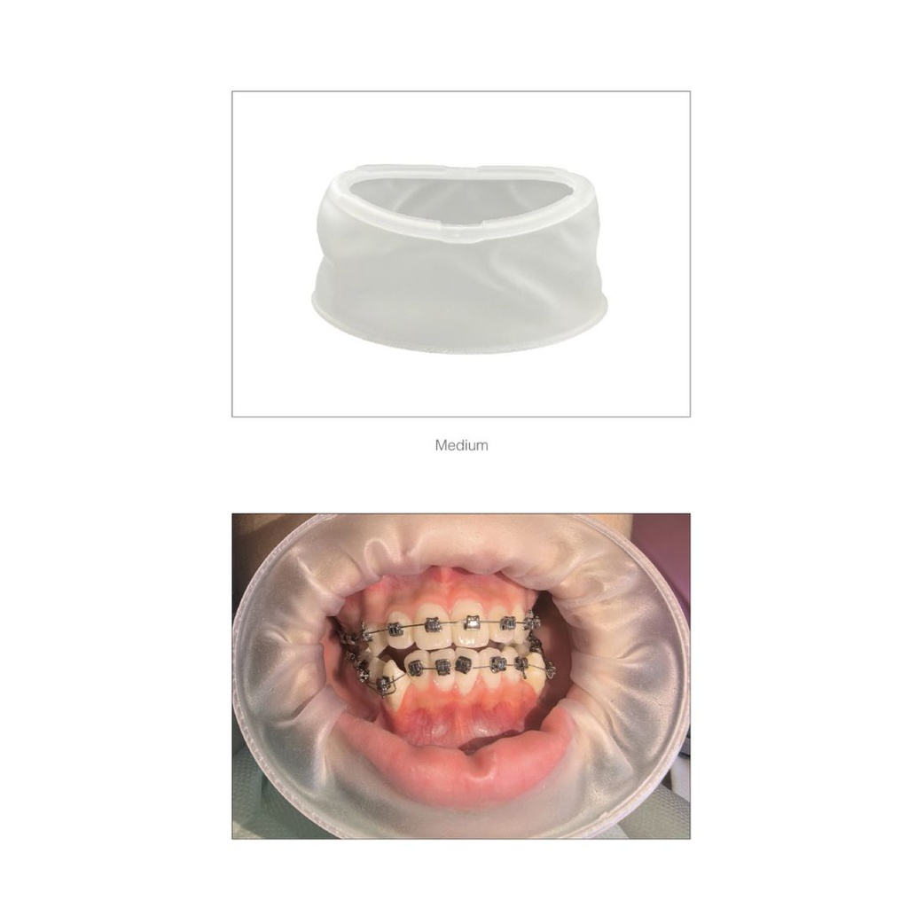 Separador labial Abreboca sin látex tipo Optragate x 1 ZT dental