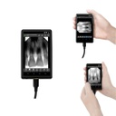 Visualizador de imagenes digital para sensor intraoral Youjoy