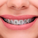 Brackets Autoligado Orthoclip SLB U-Clip Orthometric