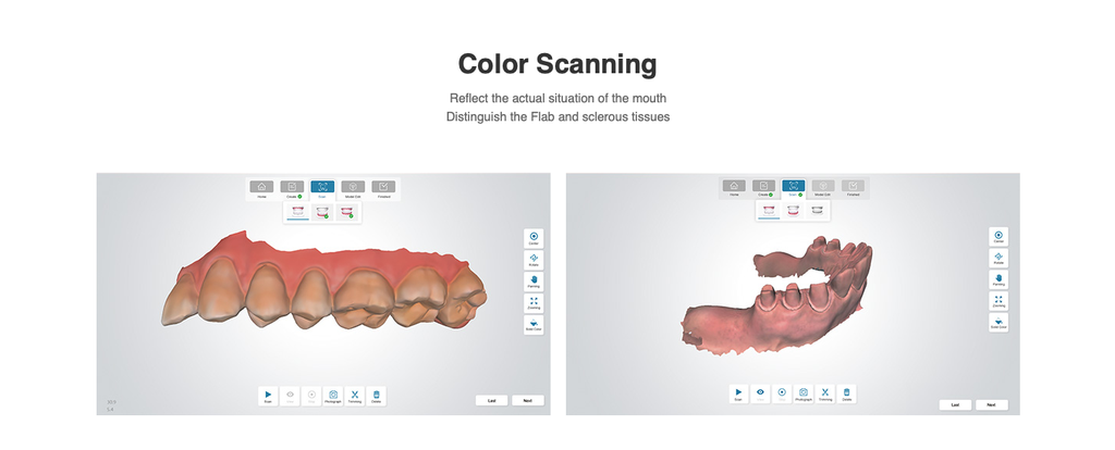 Scanner Intraoral 3D Fussen