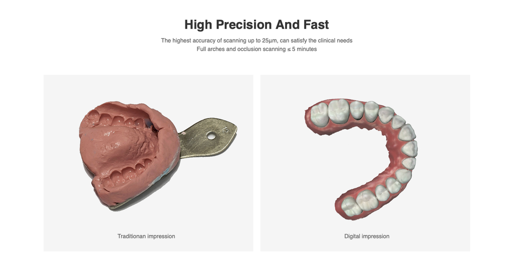 Scanner Intraoral 3D Fussen