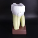 Macromodelo Molar Magnético Machtig