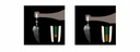 Motor Endodoncia y Loc.Ápice Endo Radar Woodpecker