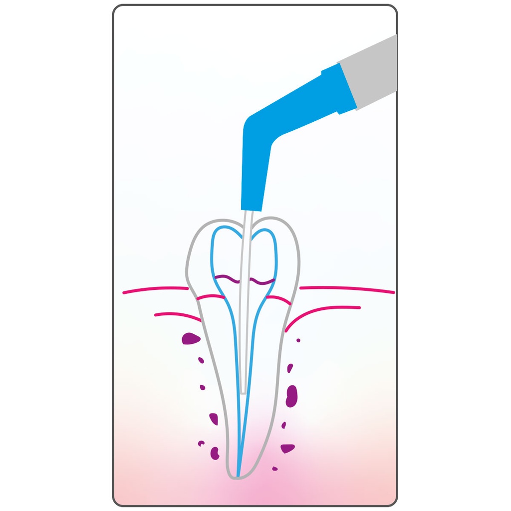 Cánulas Aspiración para Endodoncia Cotisen