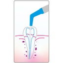 Cánulas Aspiración para Endodoncia Cotisen