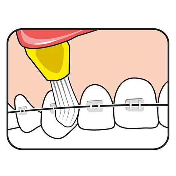 Cepillo dental Especial Interspace Soft Tepe