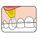 Cepillo dental Especial Interspace Soft Tepe