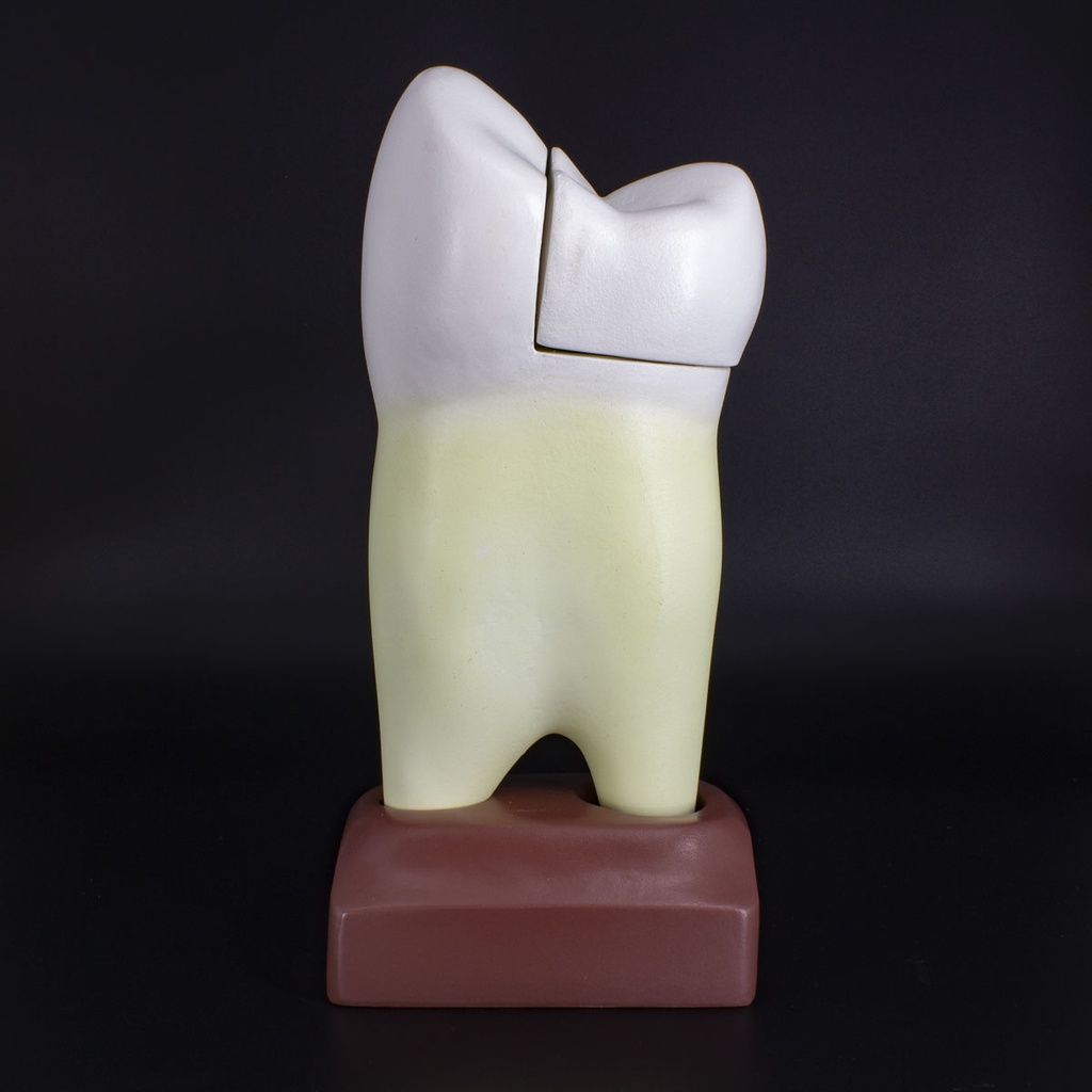 Macromodelo Premolar Magnético Machtig