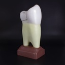 Macromodelo Premolar Magnético Machtig