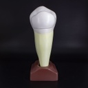 Macromodelo Premolar Magnético Machtig