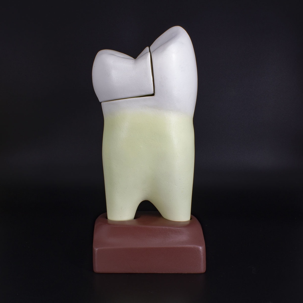 Macromodelo Premolar Magnético Machtig