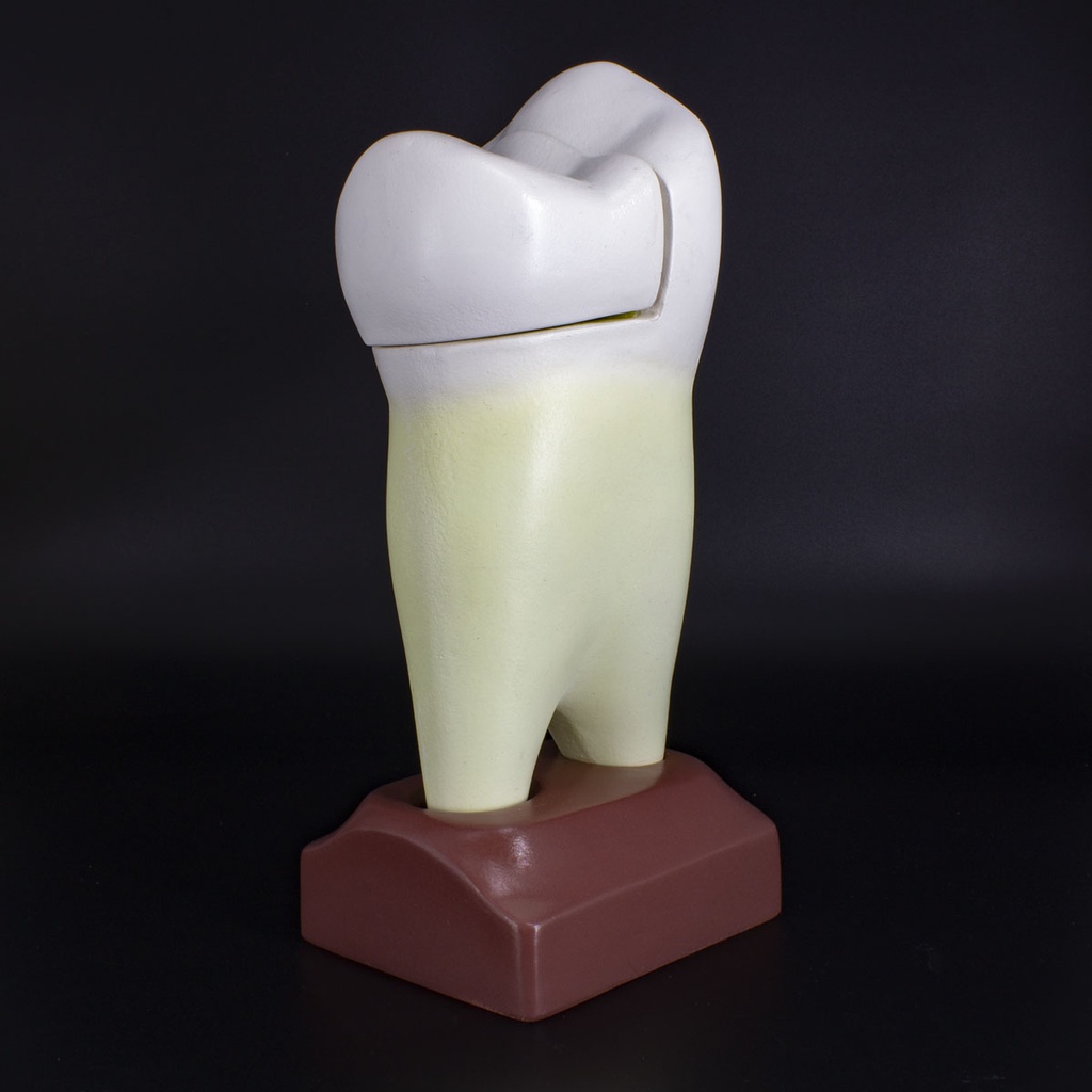 Macromodelo Premolar Magnético Machtig