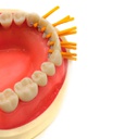 Cordón estabilizador elástico Stabilizing cord ZT Dental