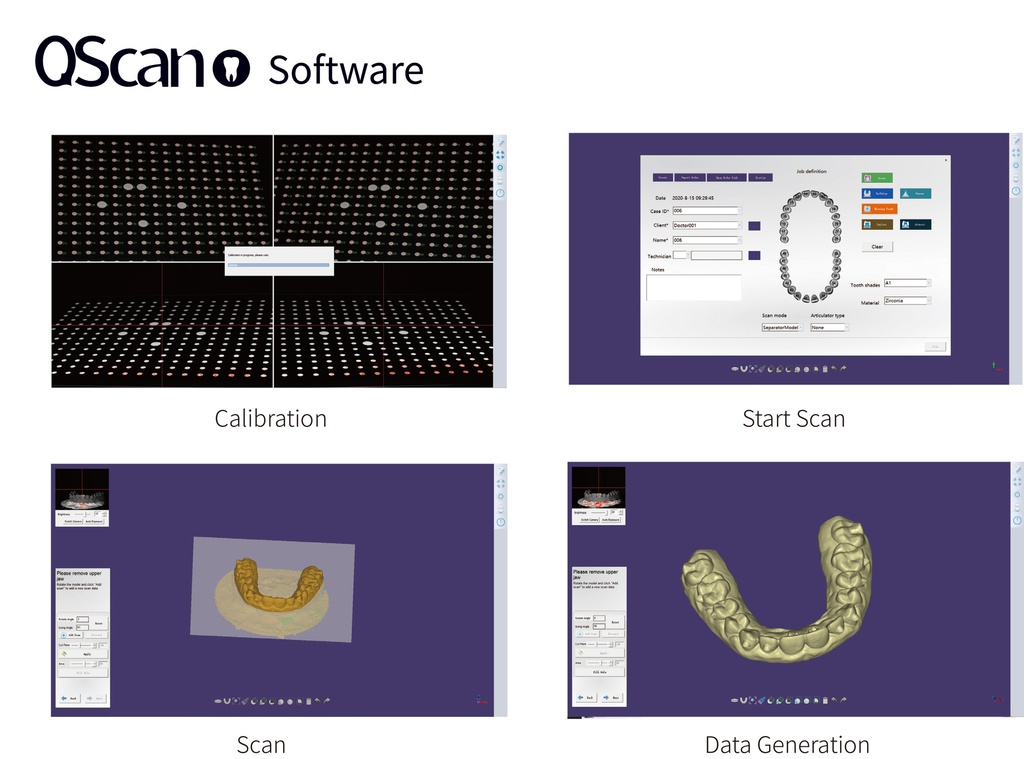 Scanner digital QScan Cedu3D