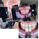 Set de Flash dual para Fotografía dental Ehros