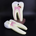 Modelo estudio Molar Magnético Machtig