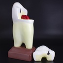 Modelo estudio Premolar Magnético Machtig