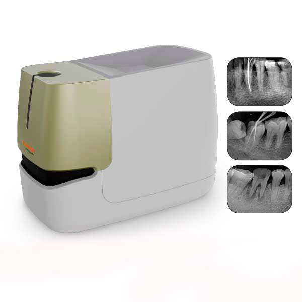 Scanner Digital Placa Fosfato F200 Fussen