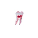 Modelo 3D Molar Superior Machtig