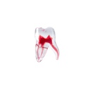 Modelo estudio 3D Molar Inferior Machtig