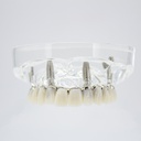 Modelo estudio y práctica Rehabilitación con 4 tornillos Max. Superior M6001-1 Machtig