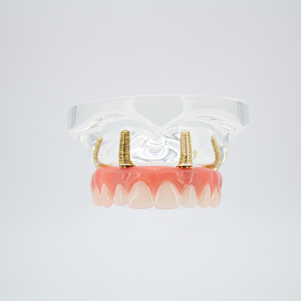 Modelo estudio y práctica Rehabilitación Prótesis con 4 tornillos Max. Superior Machtig